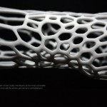 Cortex: 3D-Printed Exo-skeleton Casts